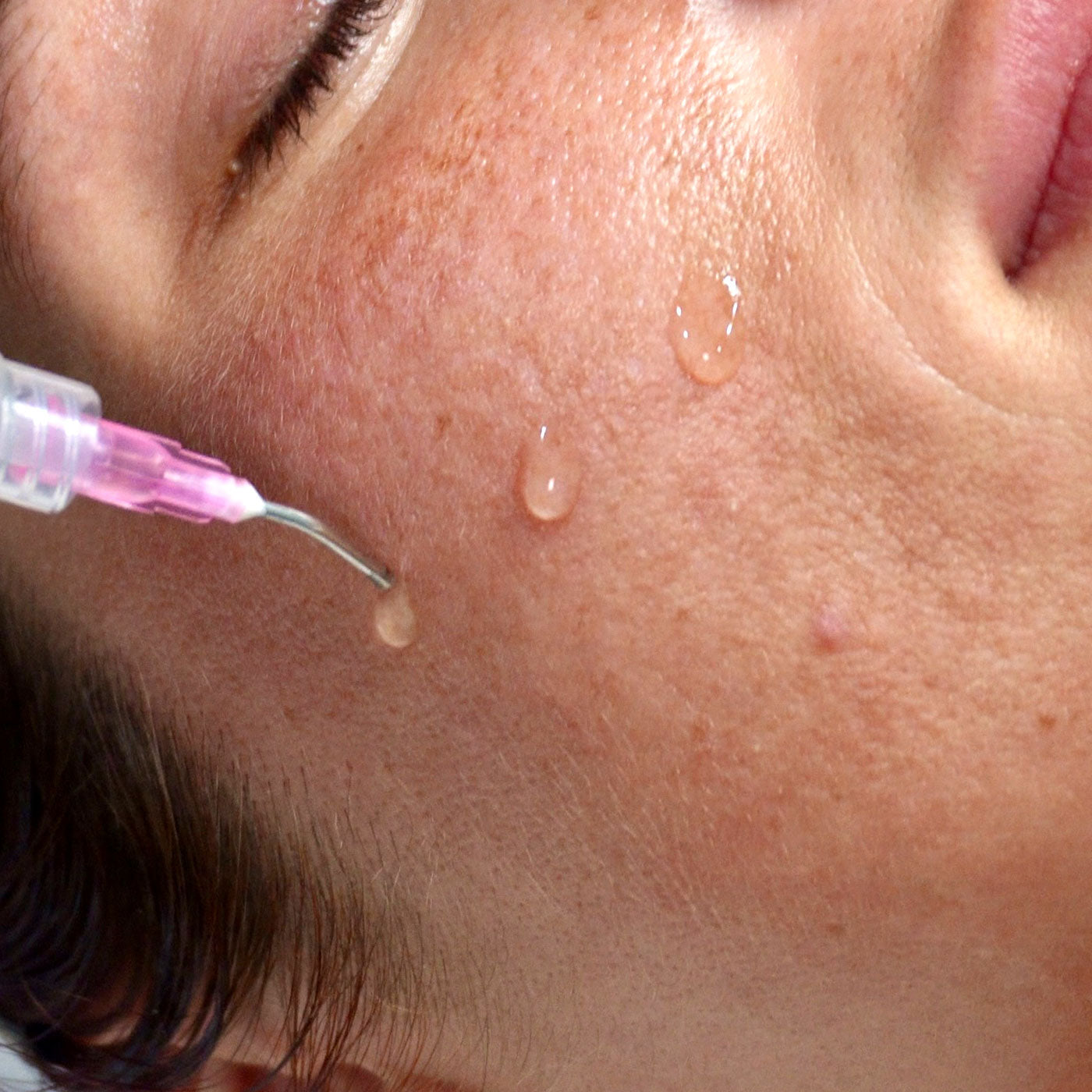 Tips and Treatments for Autumn-SpaDerma