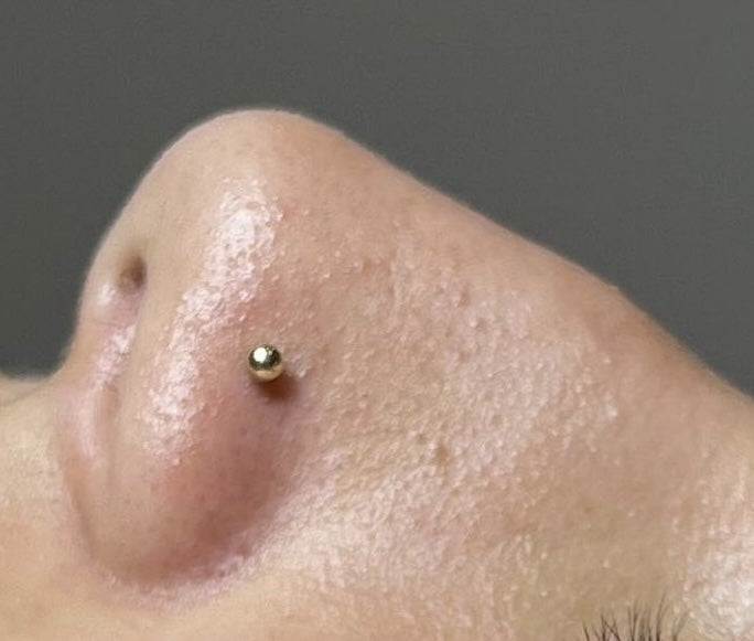 Hydrafacial_Before_Results