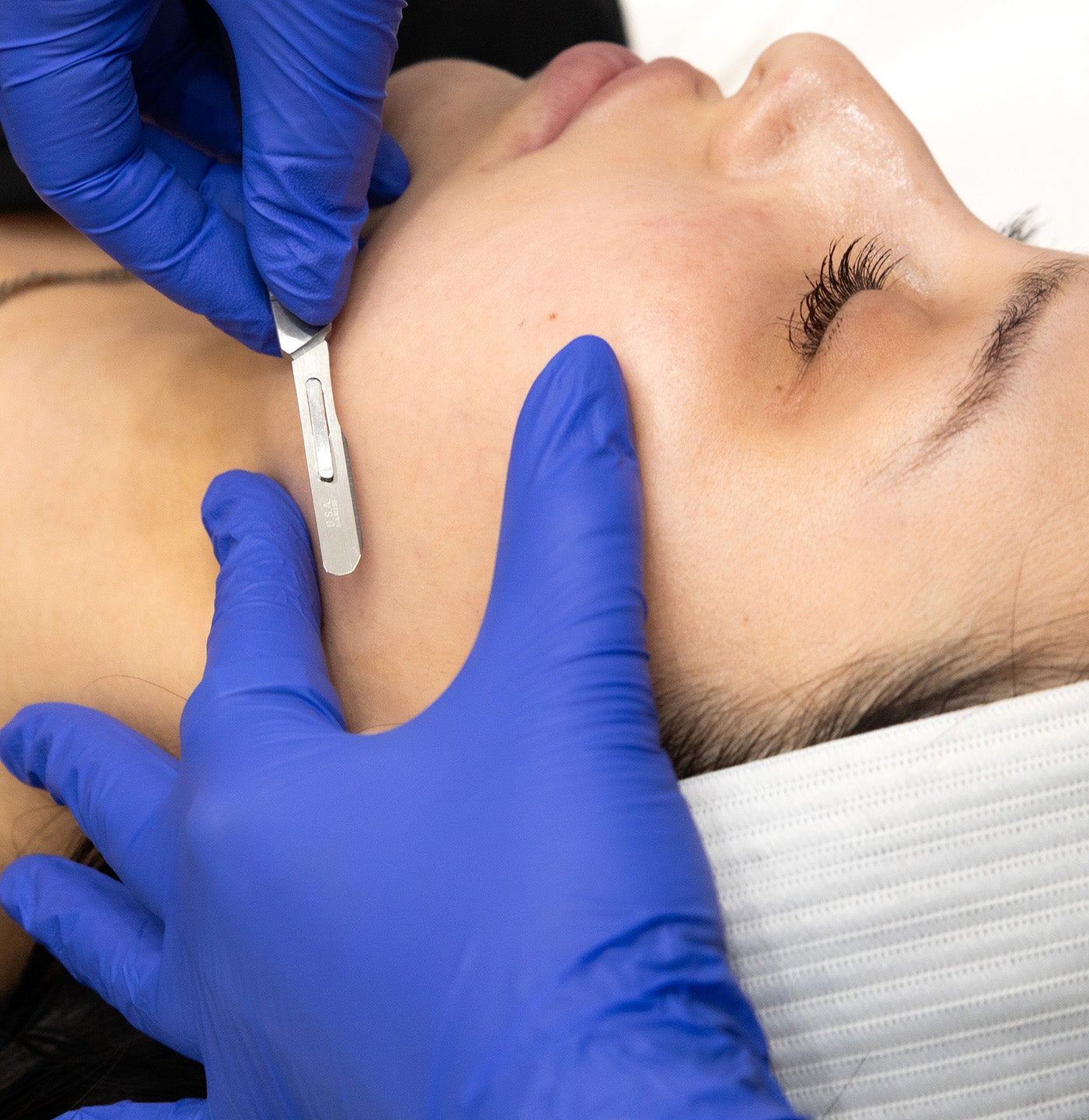 Spaderma_Web_Treatments_1400x14401_ba8e378b-19a5-4797-9bfb-36f65c43da0c.jpg