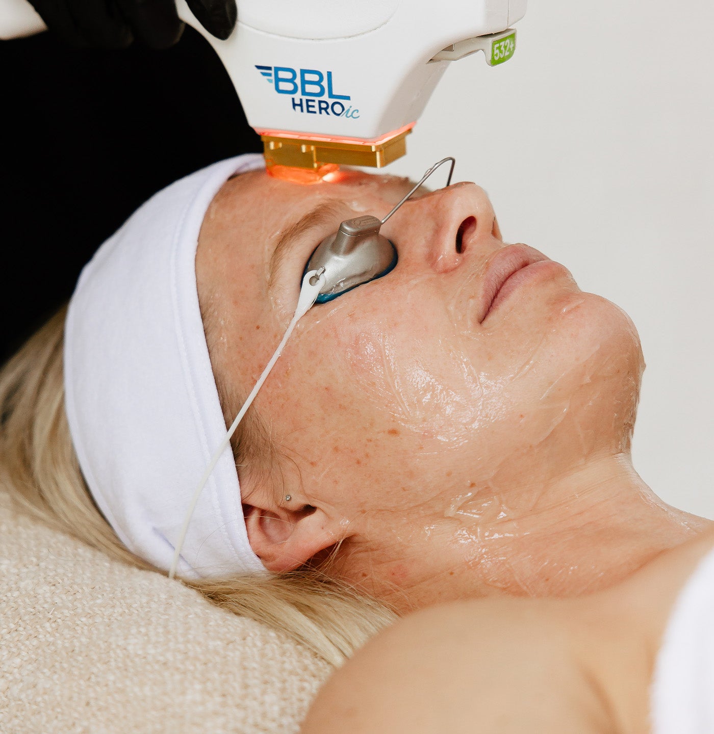 SpaDerma-BBL-SpaDerma