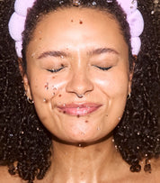 SpaDerma-Hydrafacial-SpaDerma