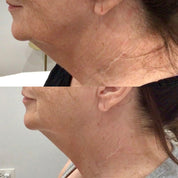 SpaDerma-PRX-SpaDerma