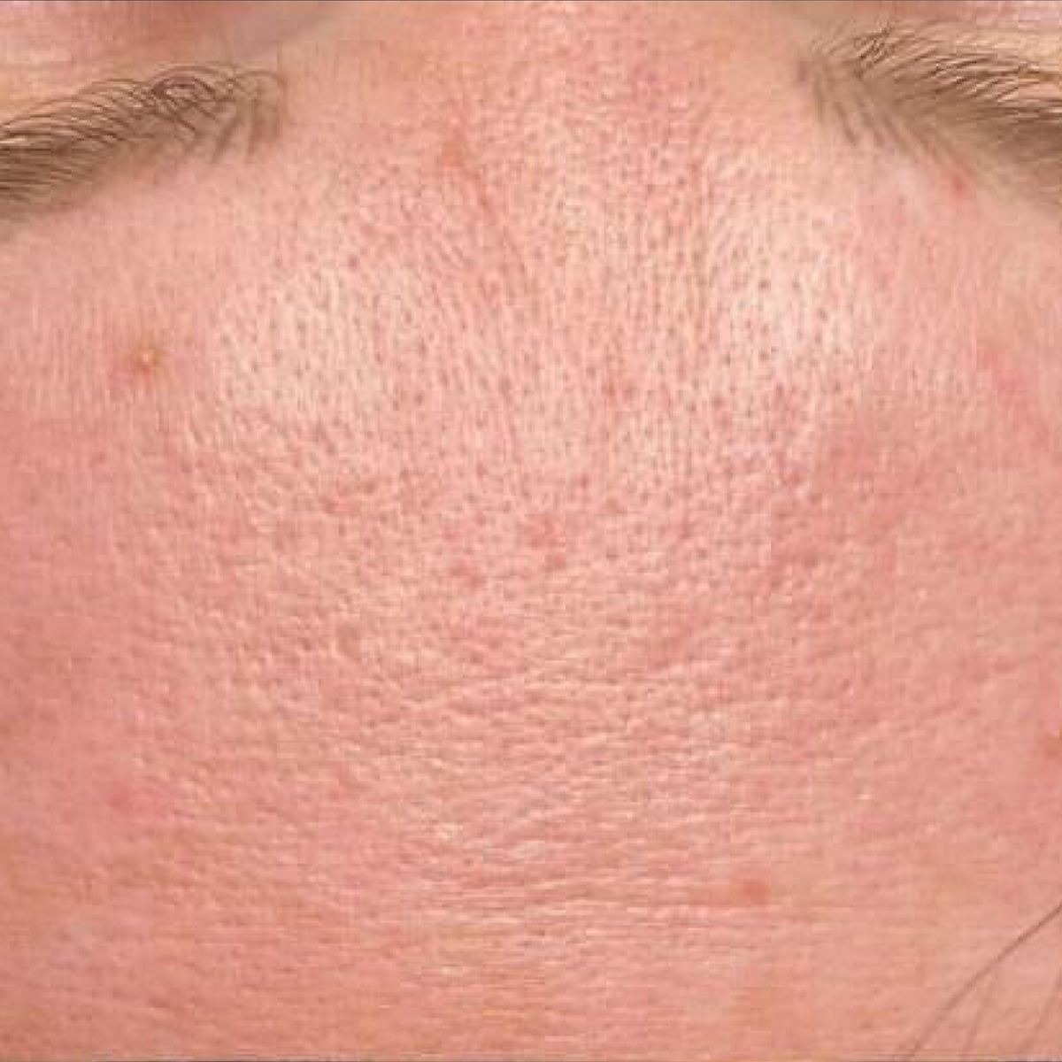 after_1_b5cf1deb-5d66-4333-a7f5-dfd58d1f27ea