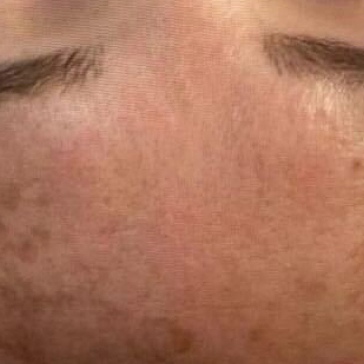 before_1_48abeb18-3261-4138-9f8c-bf275deabaeb