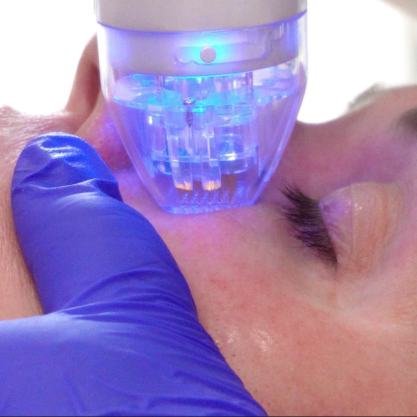 Vivace Experience at SpaDerma-SpaDerma