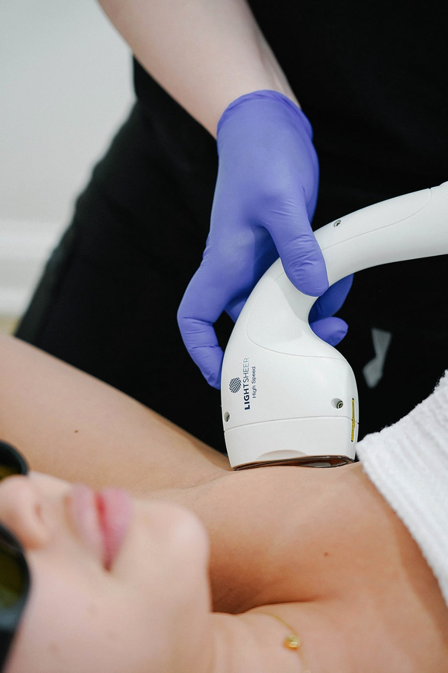 Laser Hair Removal 101
