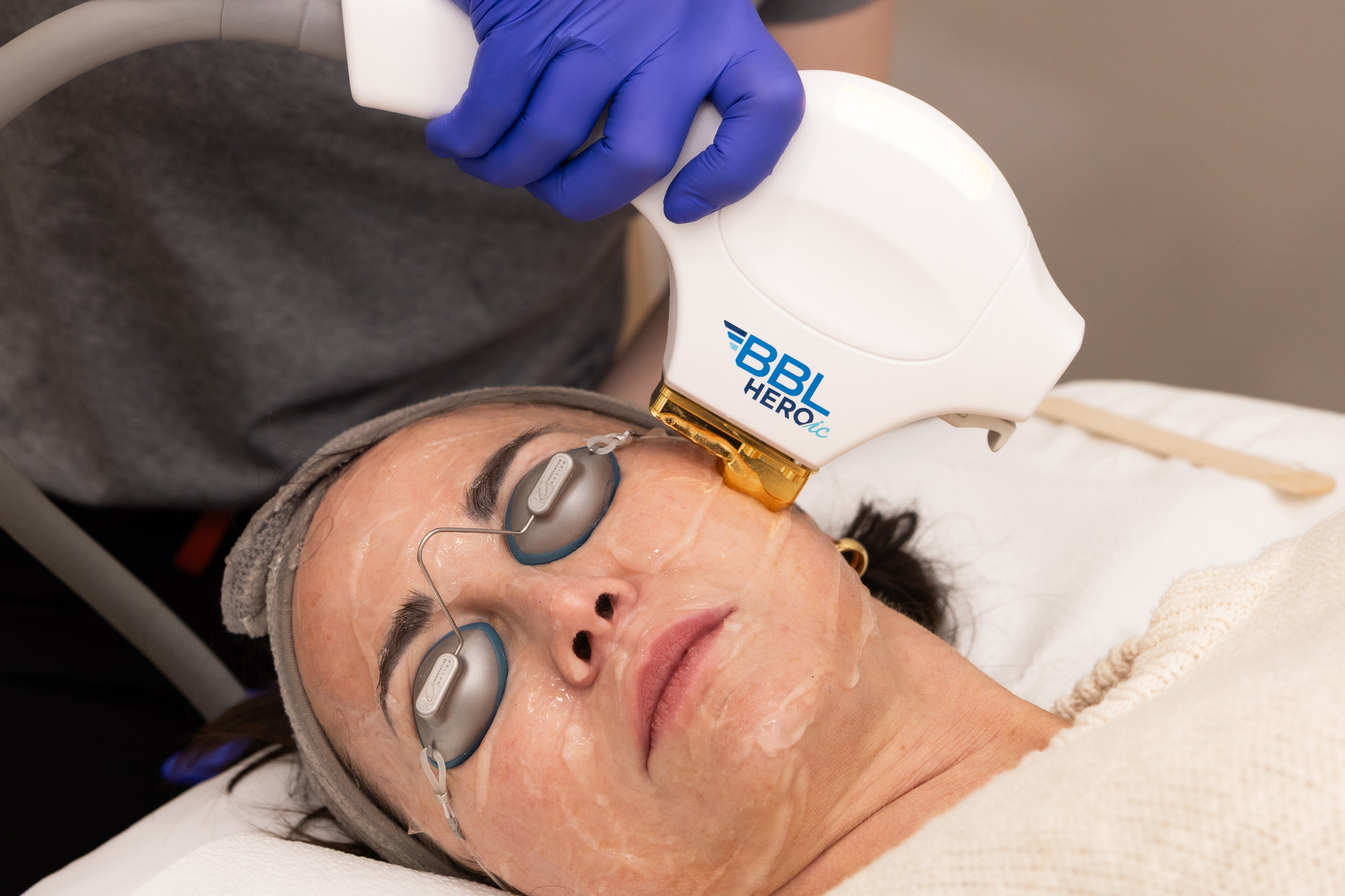 Person receiving a facial treatment with a device labeled 'BBL HERO' on their face.