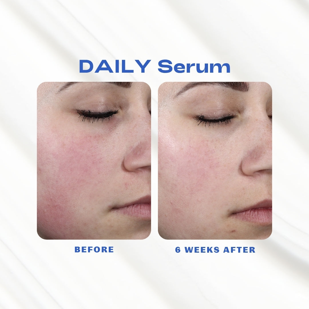 DAILY_Serum_Before_Afters.jpg