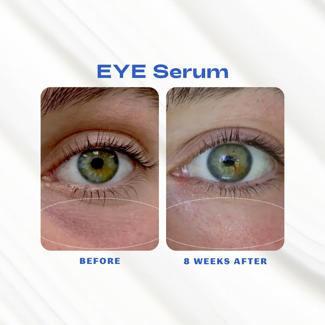 EYE_Serum_Before_Afters.jpg