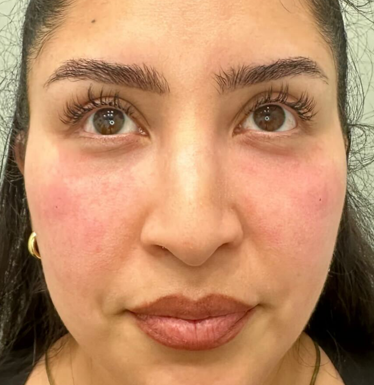 Close-up of a person's face with visible skin texture and color.