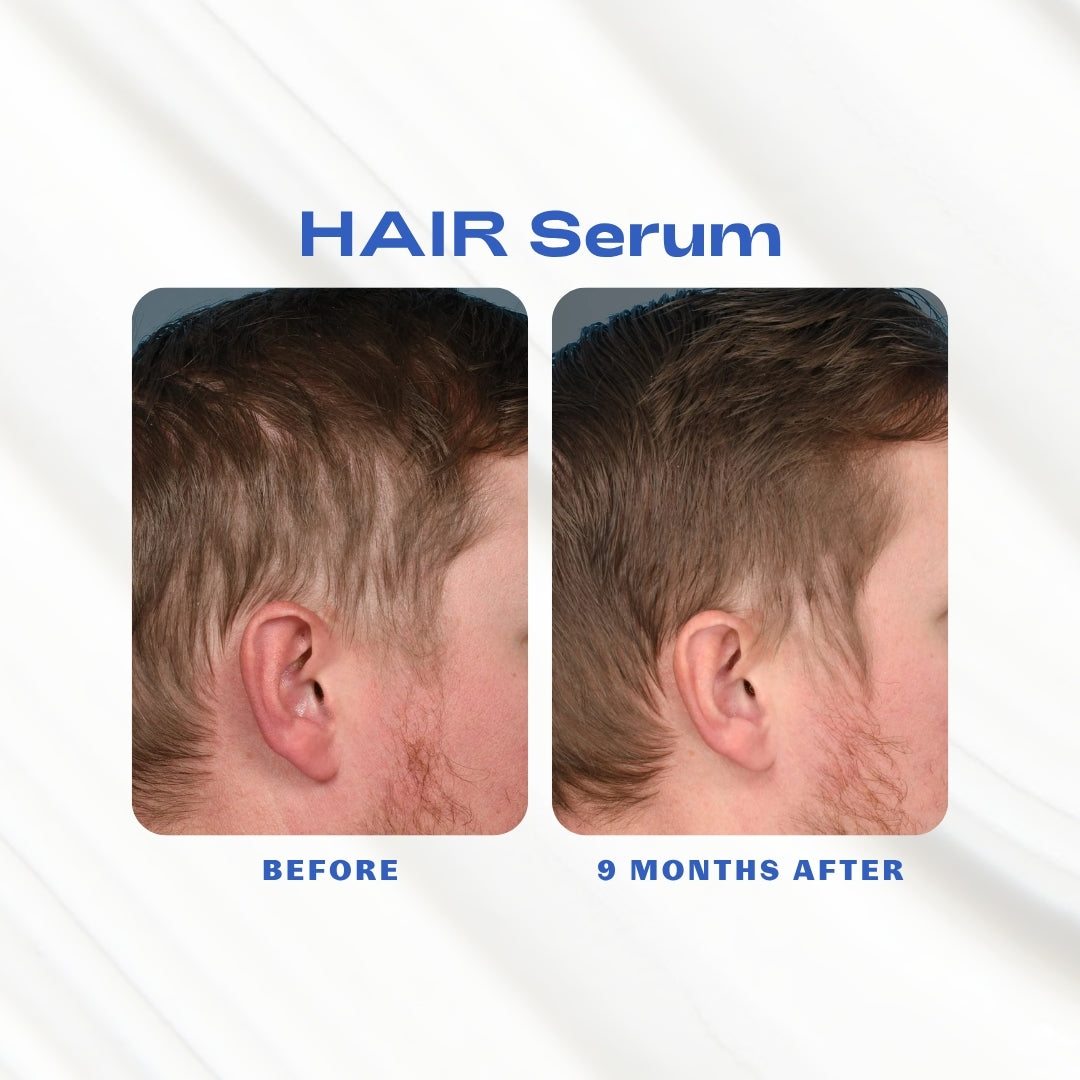 HAIR_Serum_Before_Afters.jpg