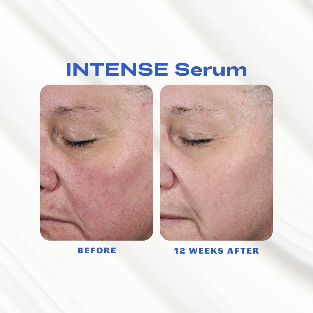 INTENSE_Serum_Before_Afters.jpg