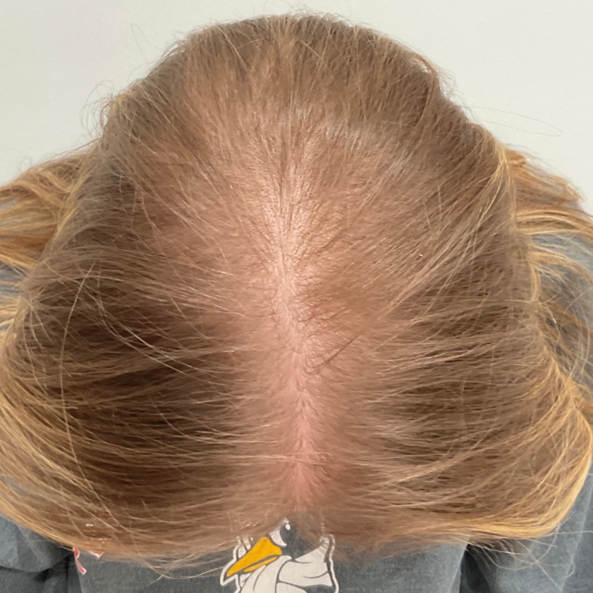 Close-up of a person's head with light brown hair on a plain background