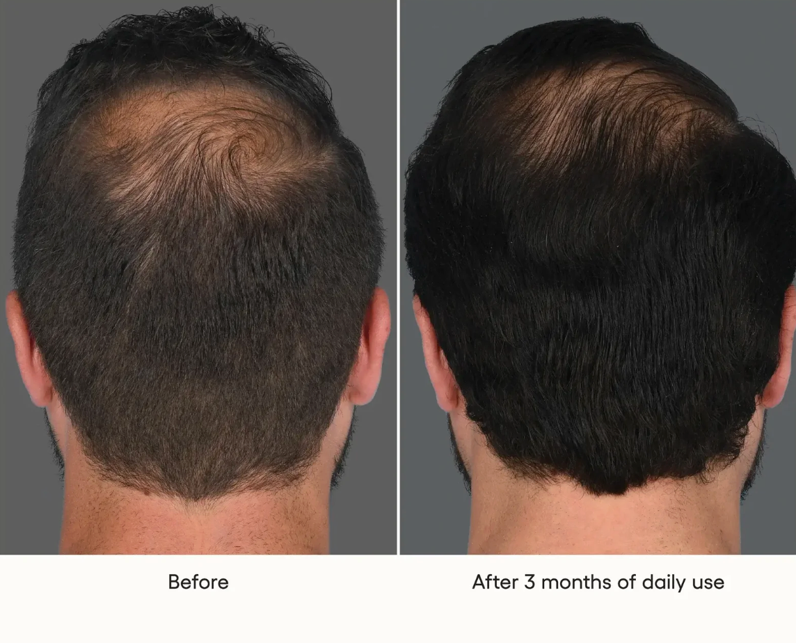 Plated_Hair_Serum_Before_and_After.png