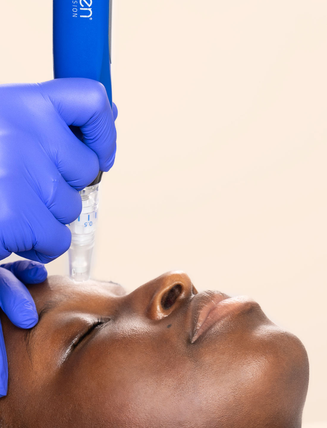 model getting skin pen Microneedling