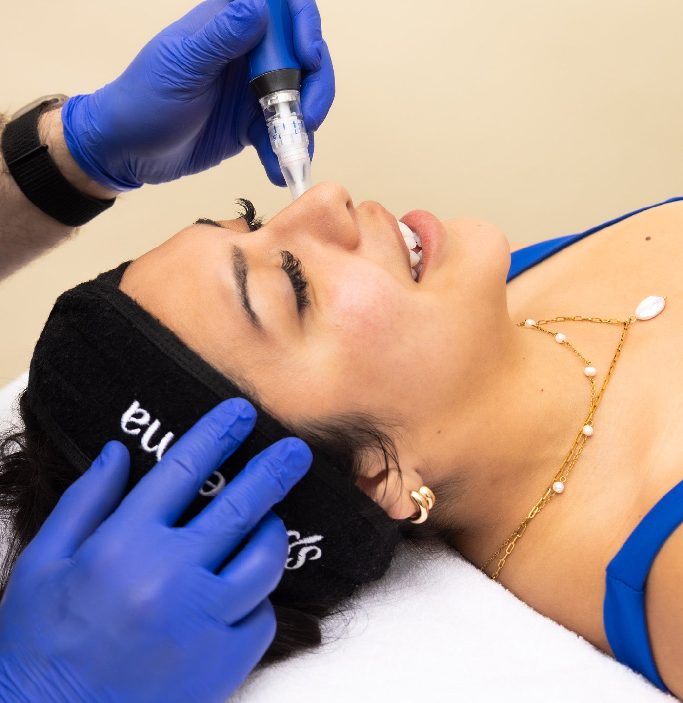 SkinPen Microneedling