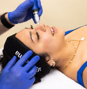 SkinPen Microneedling