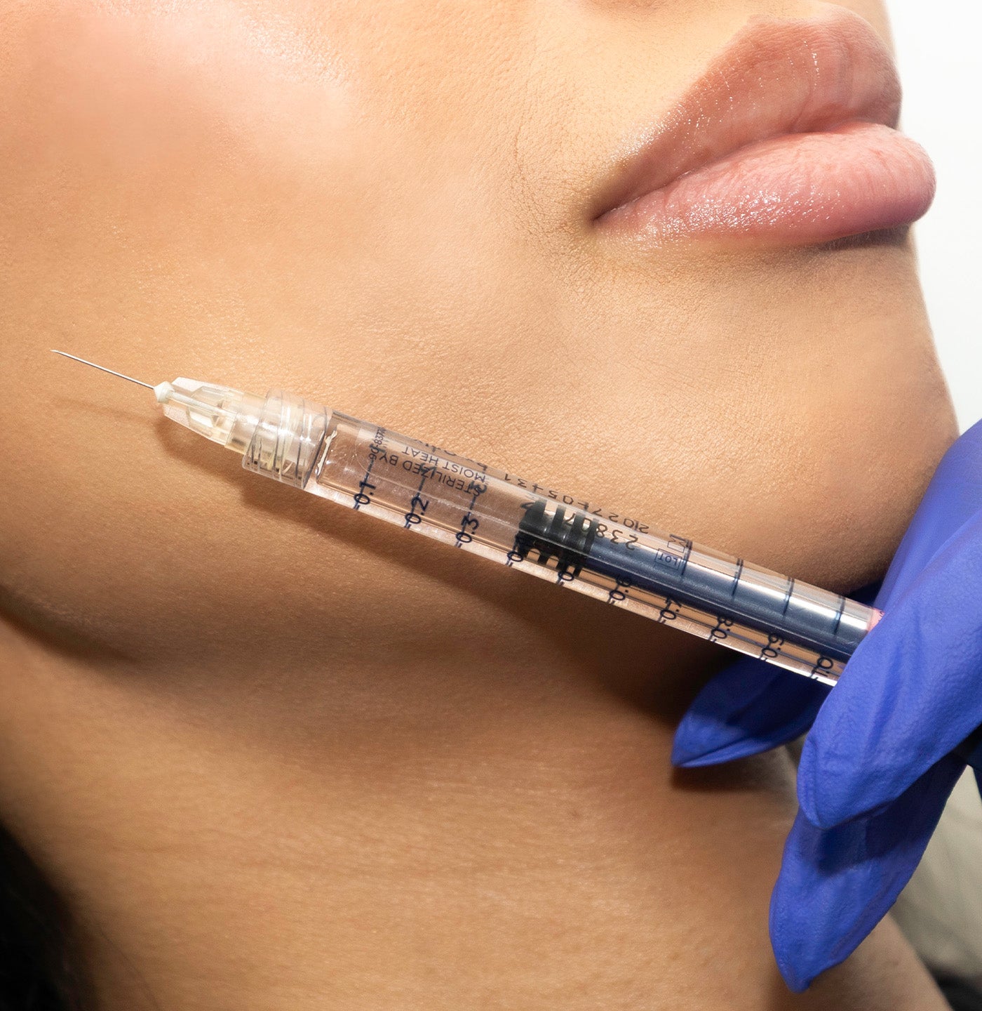 Facial Fillers
