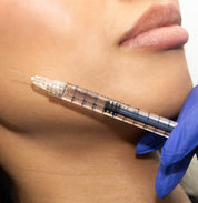 Facial Fillers