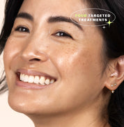Uneven Skin Tone Series