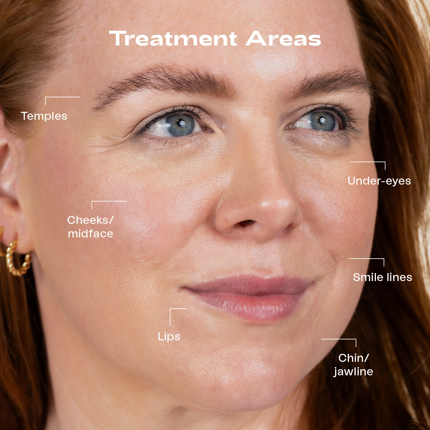 Spaderma_Web_Treatments_1400x14403_copy_a82463d5-5aee-48f5-adbc-101ee4b6ae6c.jpg