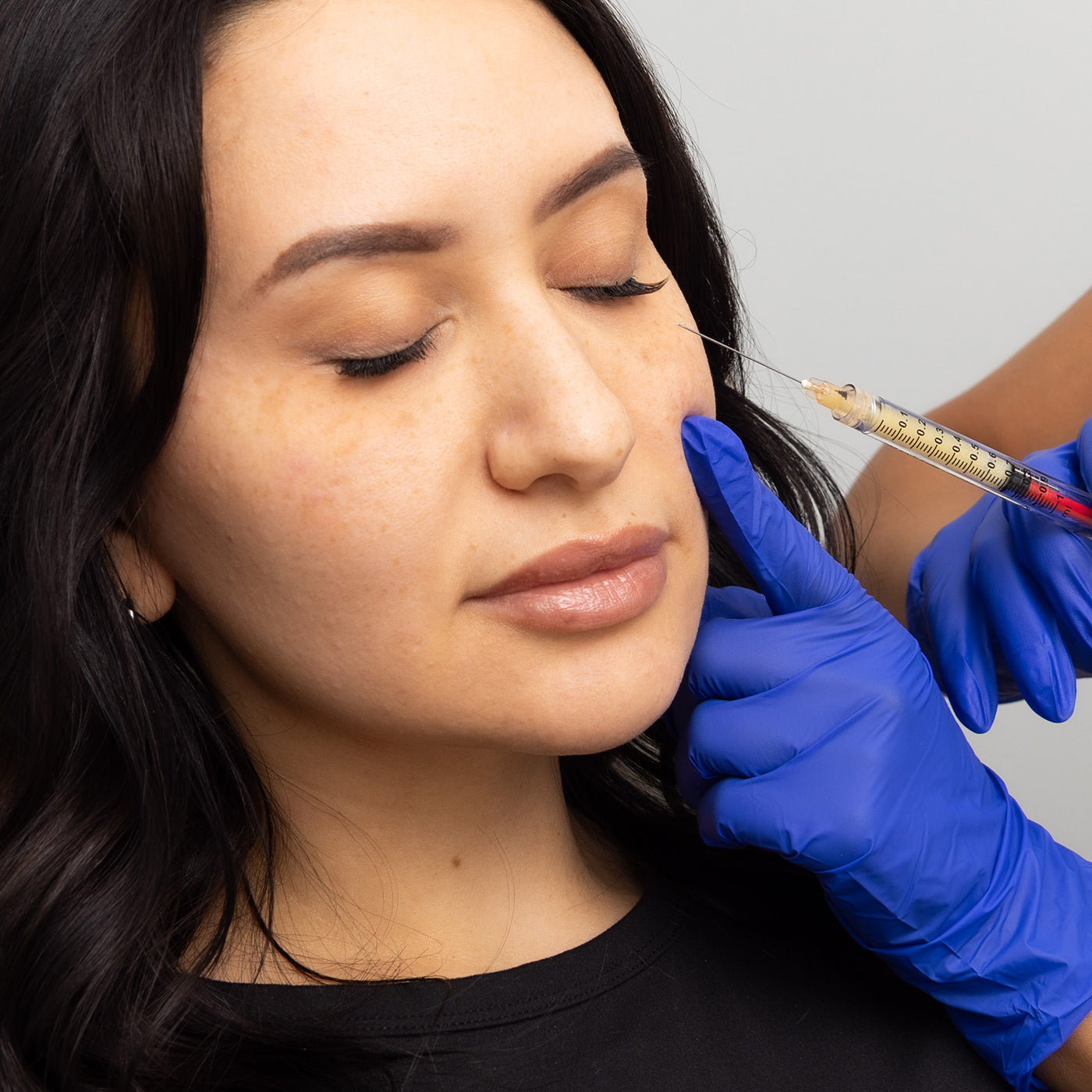 Spaderma_Web_Treatments_ACE_1600x14401_7b96f082-e6a3-4291-ab76-e4a0a0d3ad9f.jpg