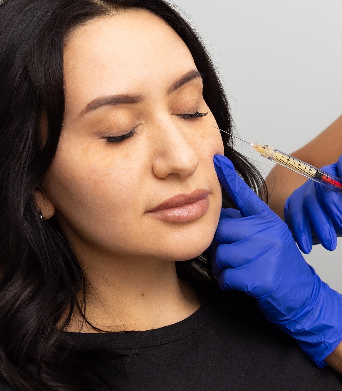 Spaderma_Web_Treatments_ACE_1600x14401_7b96f082-e6a3-4291-ab76-e4a0a0d3ad9f.jpg