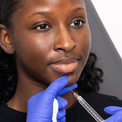 Facial Fillers