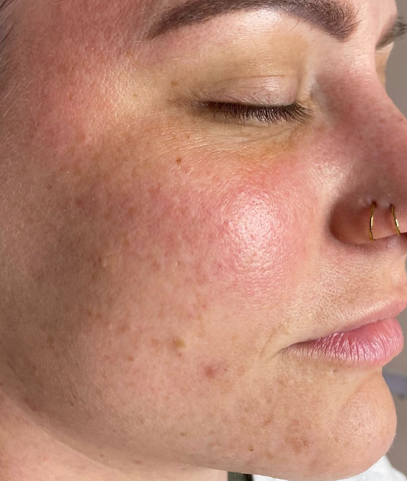 The Uneven Skin Tone Series is a perfect solution to achieve your skincare goals while eliminating the guesswork!