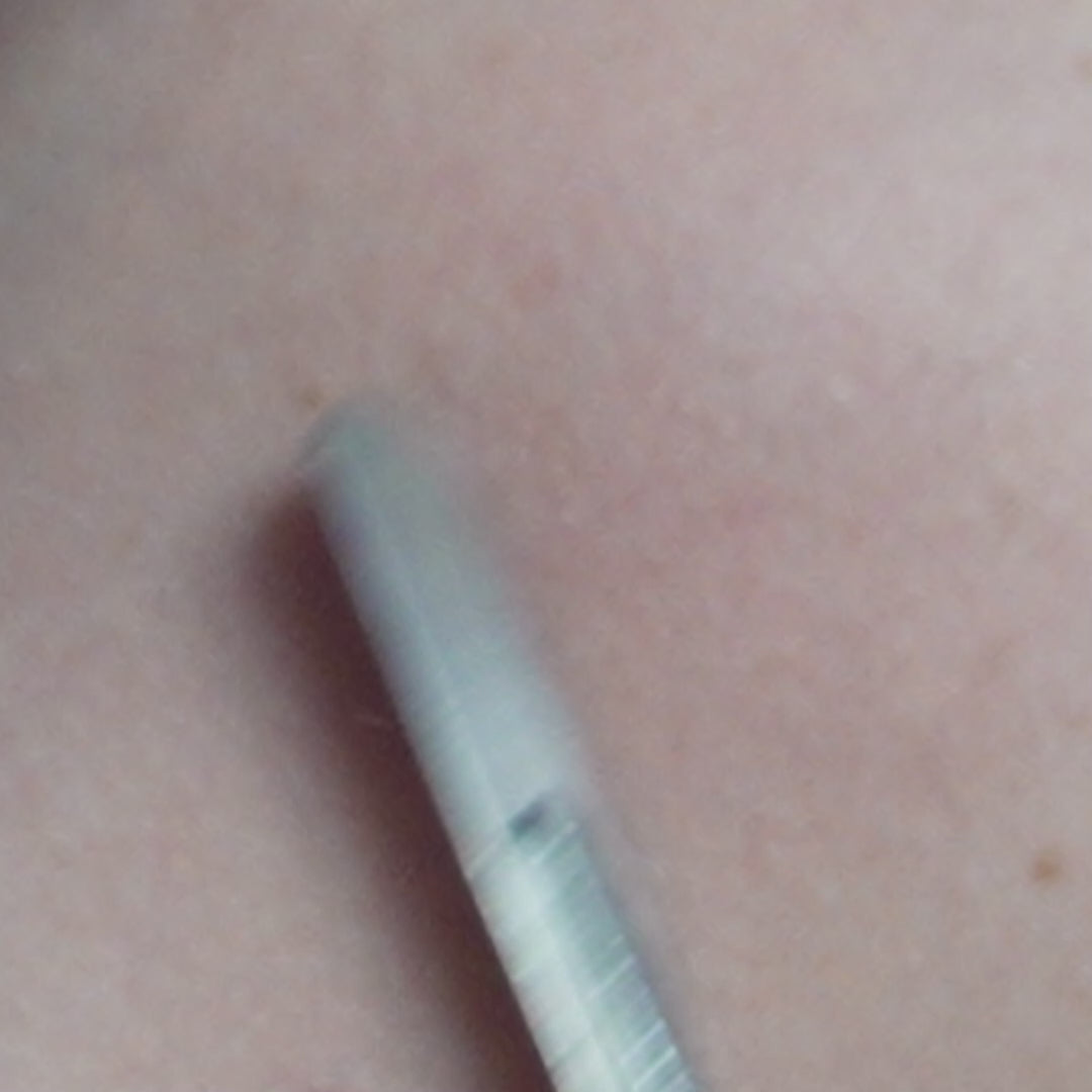 Derm resurfacing at SpaDerma will leave your skin feeling smooth and refreshed!